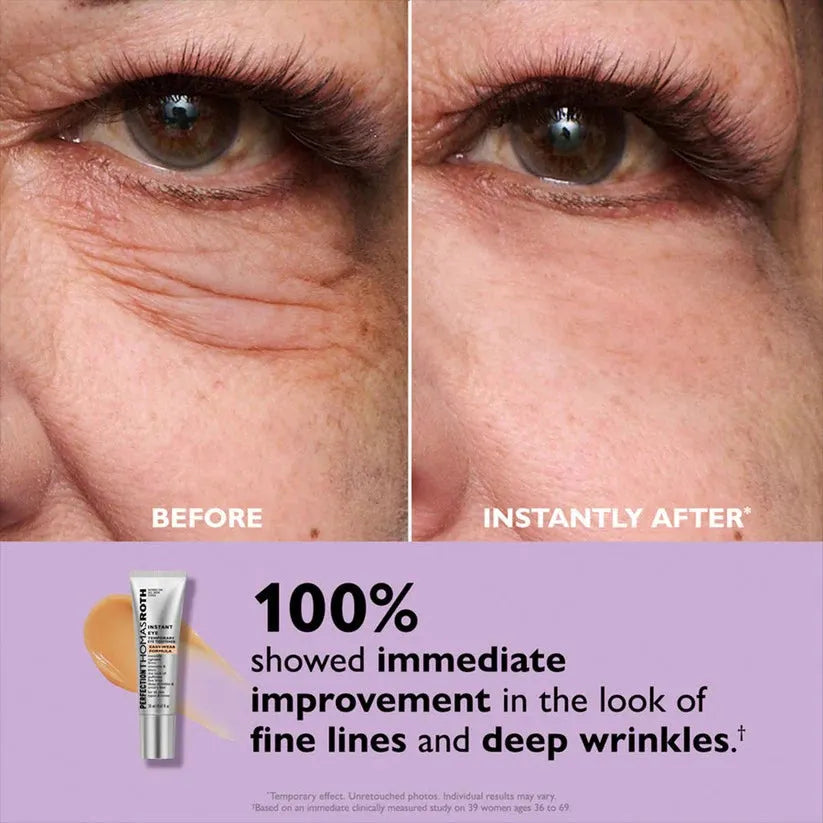 ⚡Eye Bags Making You Look Older Than You Feel? Reveal A Firmer, Smoother-Looking Eye Area Instantly.