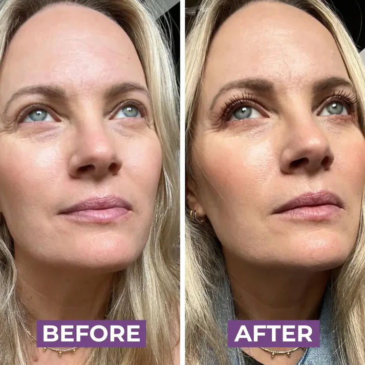 🔥50% OFF-UXOL® Eyelash Growth Serum