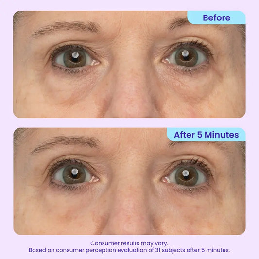 LAST DAY - BUY 1 GET 1 FREE💜Instant Lift Eye Gel