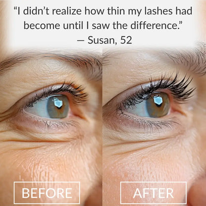 🔥50% OFF-UXOL® Eyelash Growth Serum
