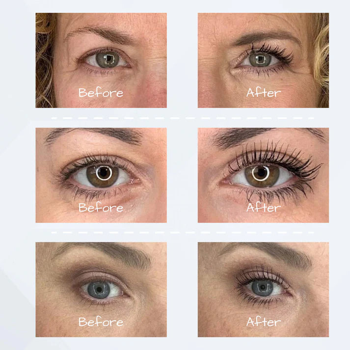 🔥50% OFF-UXOL® Eyelash Growth Serum
