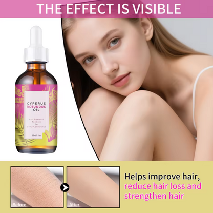 ✨UXOL®️ Cyperus Rotundus Hair Removal Oil 60ml
