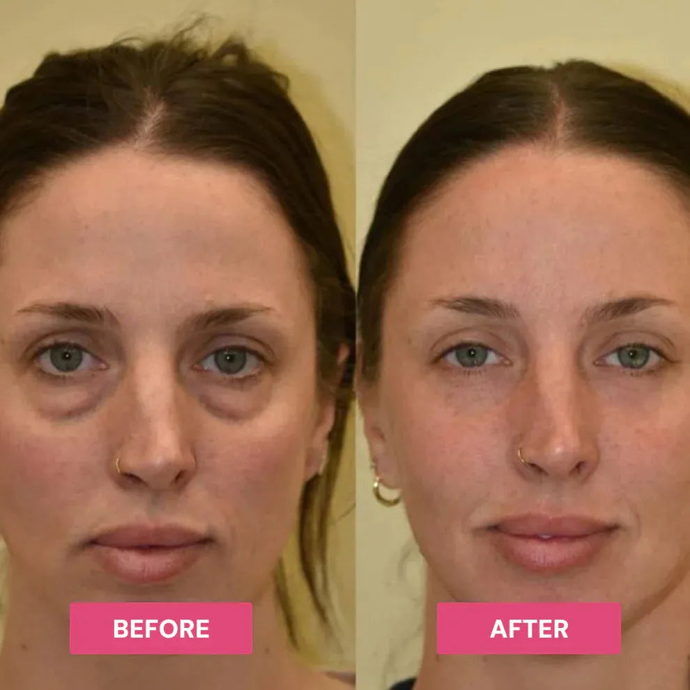 3-In-1 Lift & Firm Eye Stick-Tired-Looking Eyes Making You Look Older Than You Feel? Restore A Smoother, Brighter & More Youthful-Looking Eye Area In Seconds.
