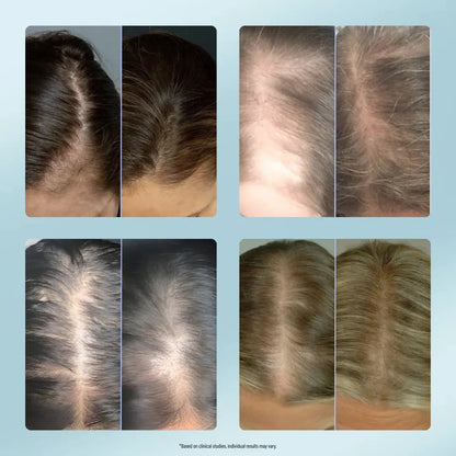UXOL® Hair Growth Serum – Bring Confidence Back to Your Life with Lush, Fuller Hair 🌿💆‍♂️