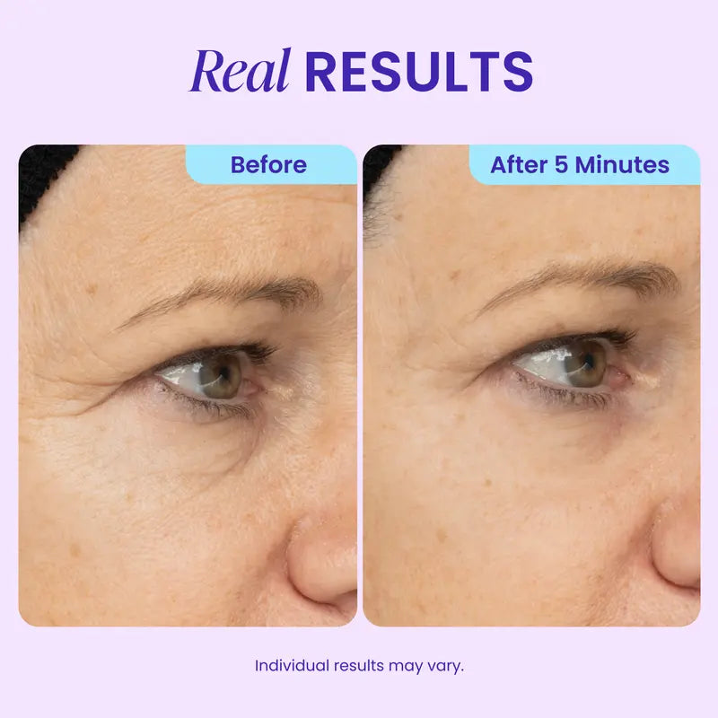 LAST DAY - BUY 1 GET 1 FREE💜Instant Lift Eye Gel