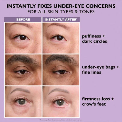 ⚡Eye Bags Making You Look Older Than You Feel? Reveal A Firmer, Smoother-Looking Eye Area Instantly.